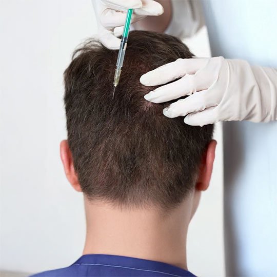 Baş Agrisi icin Sinir Bloklari