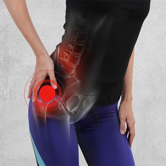 Bel Fıtığı mı, Piriformis Sendromu mu Kalça Ağrısının Gizli Kaynağını Keşfedin