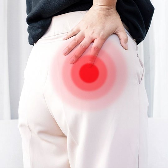 Piriformis Sendromu Nasıl Tedavi Edilir Enjeksiyon, Botoks ve Cerrahi Çözümler