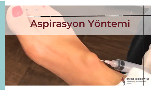 aspirasyon yontemi