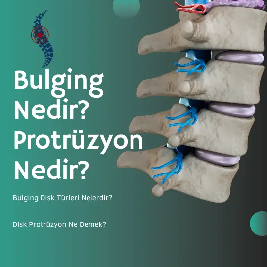 bulging nedir protrüzyon nedir 2