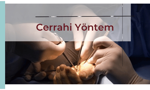 cerrahi yontem