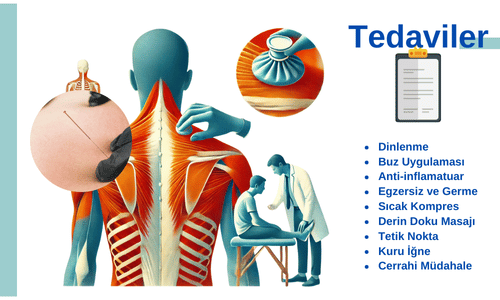 latissimus dorsi tedaviler