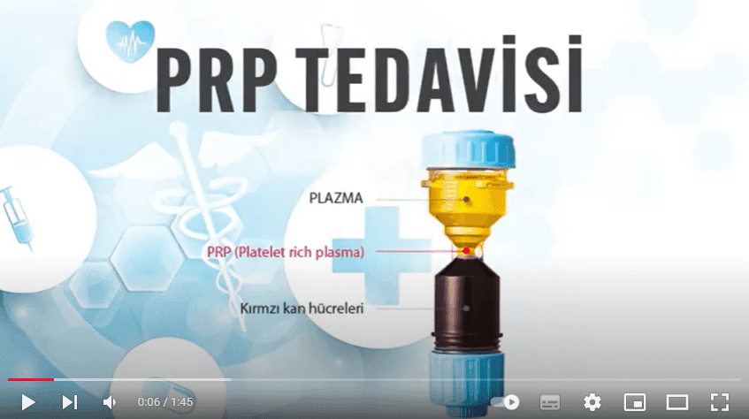 prp tedavisi