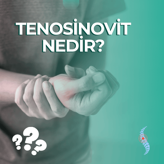 tenosinovit nedir 1